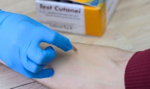 Alergii_Centrul Medical Dr Furtuna Dan